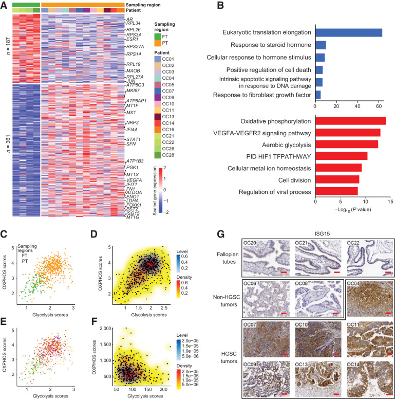 Figure 2. Dynamic changes of RNA expression from normal FTE to primary tumors. A, Heatmap showing DEGs between normal FTE and primary tumor cells. Each row represents a DEG. The color bar at the top represents sampling regions and patient origins. B, The GO enrichment of DEGs. Red: upregulated genes in primary tumor cells; blue: downregulated genes in primary tumor cells. C and E, Scatterplots of the OXPHOS and glycolysis scores of cells in our study colored by sampling regions (C) and patients (E). The colors of patients are the same as A. D and F, 2D density plots of the OXPHOS and glycolysis scores of cells in our study (D) and patients in TCGA project (F). G, IHC determination of ISG15 expression in FTE, non-HGSC, and HGSC tumors. Scale bar, 40 μmol/L.