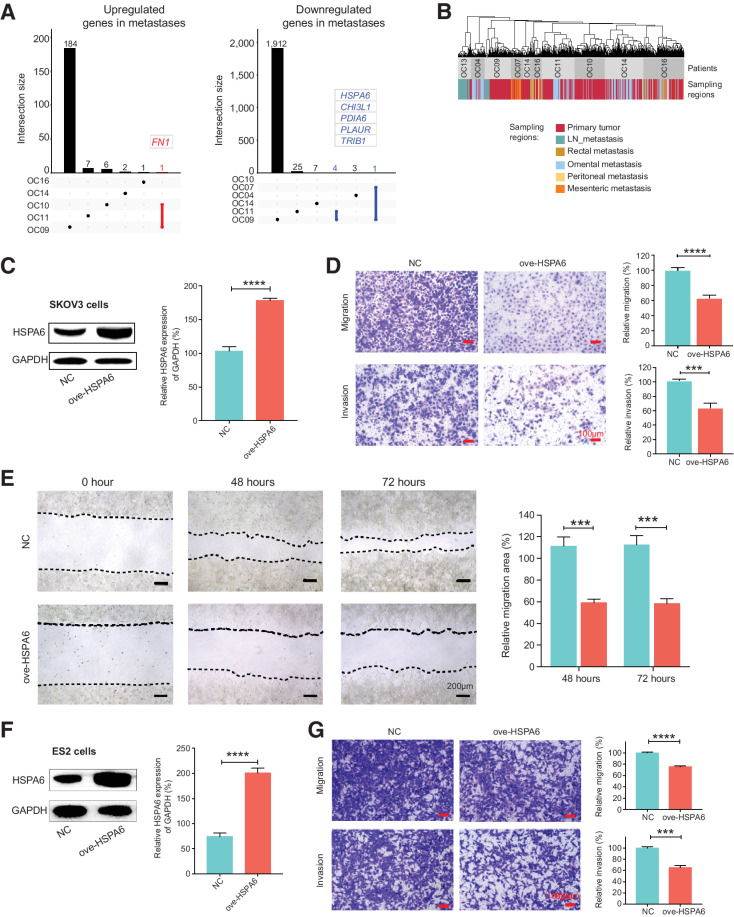 Figure 5. Dynamic changes of RNA expression from primary tumors to metastases. A, UpSet plot visualization of the DEGs between primary tumors and matched metastases. Left: genes upregulated in metastases; right: genes downregulated in metastases. B, Shared nearest neighbor (SNN) clustering of cancer cells of patients with metastases based on RNA expression. C and F, Western blot analysis to verify the overexpression of HSPA6 in SKOV3 cells (C) and ES2 cells (F; *, P < 0.05; **, P < 0.01; ***, P < 0.001; ****, P < 0.0001). D and G, The migration and invasion ability of SKOV3 cells (D) and ES2 cells (G) after HSPA6 overexpression were assessed by transwell assay. Scale bar, 100 μmol/L (*, P < 0.05; **, P < 0.01; ***, P < 0.001; ****, P < 0.0001). E, The migration ability of SKOV3 cells after HSPA6 overexpression was assessed by wound healing assay. Scale bar, 200 μmol/L (**, P < 0.01).