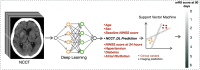 The architecture of the fused model includes a three-dimensional
ResNet-based deep learning (DL) noncontrast-enhanced CT (NCCT; NCCT_DL)
model for imaging-based predictions as well as a nonlinear support vector
regression to integrate clinical variables. The fused model accepts both the
DL NCCT predictions and the clinical variables listed as inputs. The fused
model produces a continuous prediction of 90-day modified Rankin Scale (mRS)
scores. A support vector regression using only clinical variables is defined
as the clinical model, whereas a support vector regression that incorporates
both clinical variables and DL NCCT predictions is defined as the fused
model. NIHSS = National Institutes of Health Stroke Scale.