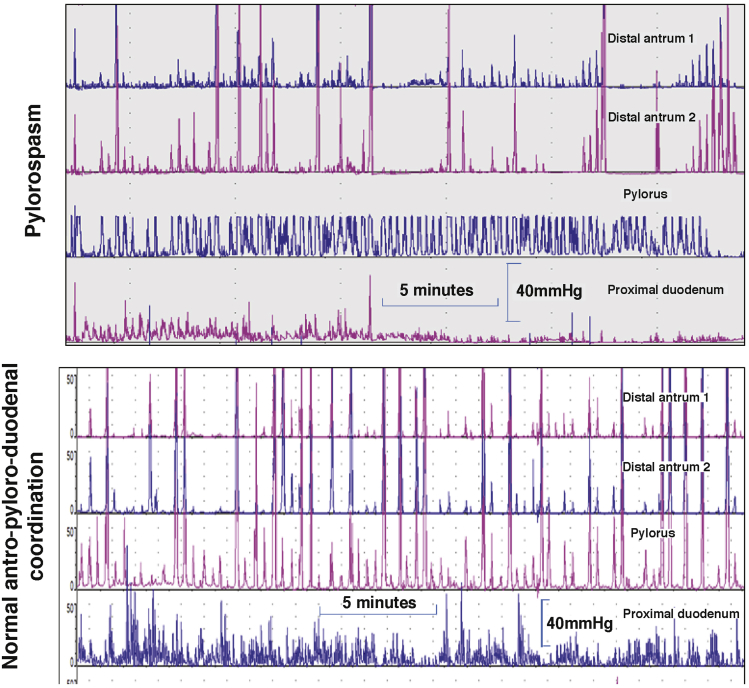 Figure 2