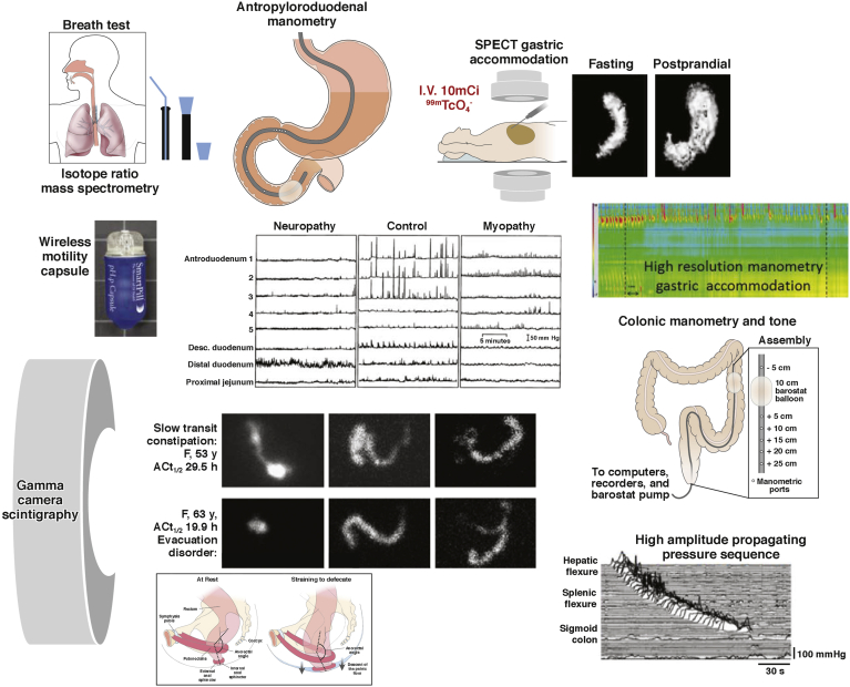 Figure 1