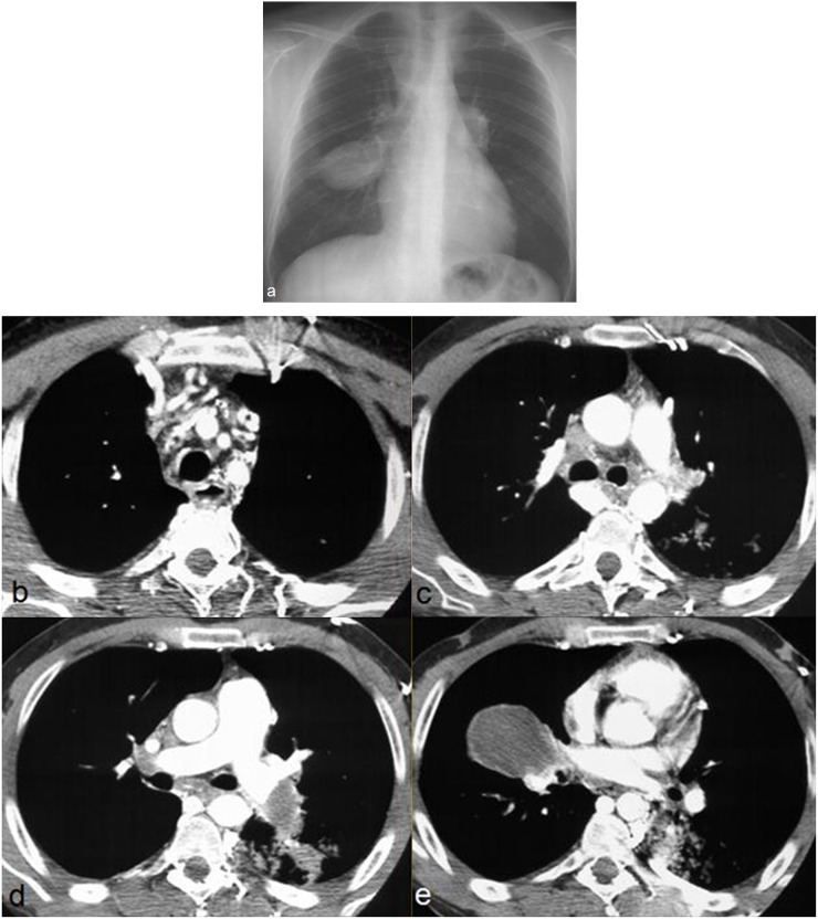 Figure 11.