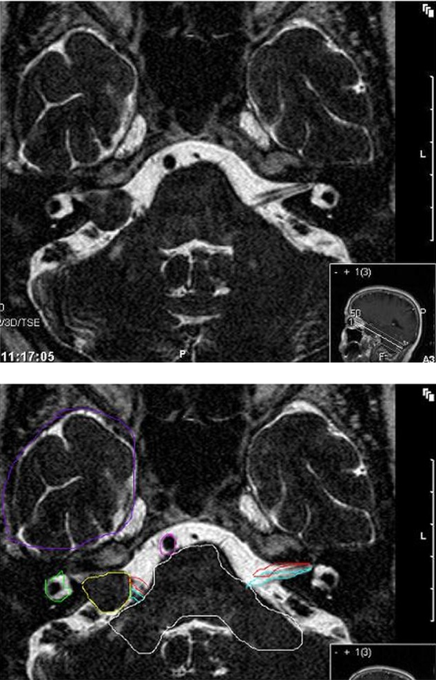 Figure 1