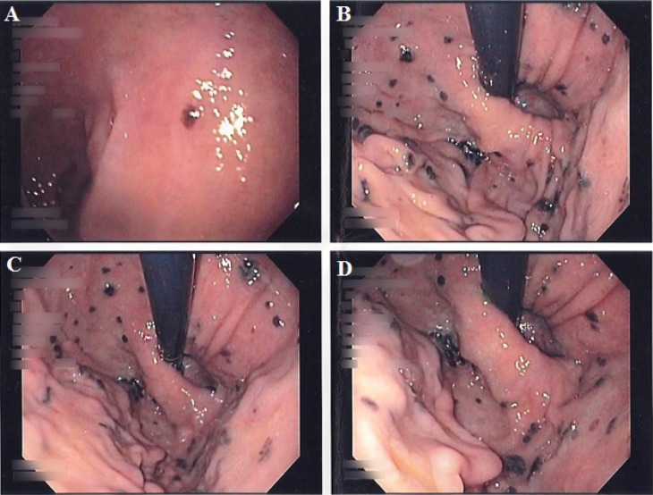 Fig. 2