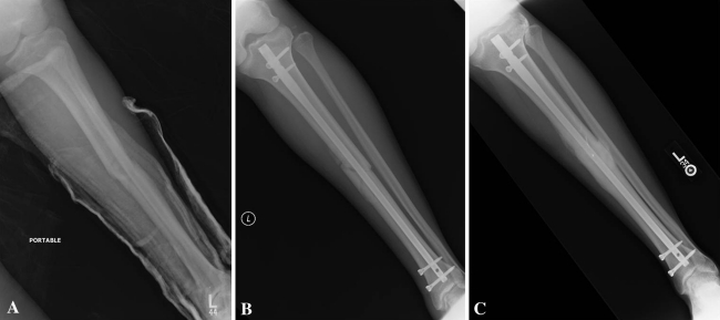 Fig. 1A–C