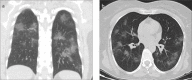 Figure 2. a, b