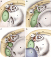 Fig. 2