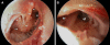 Fig. 13