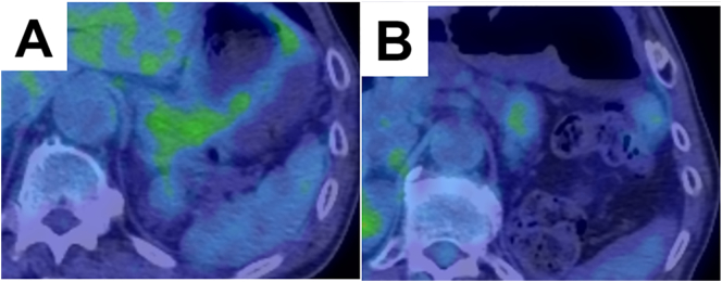 Fig. 4