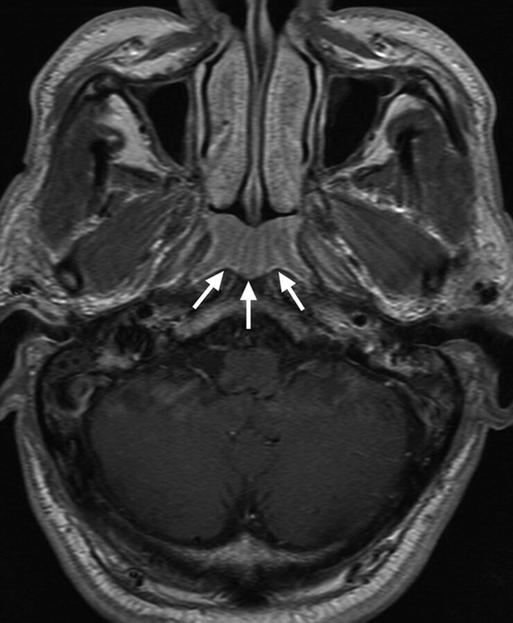 Fig 4.