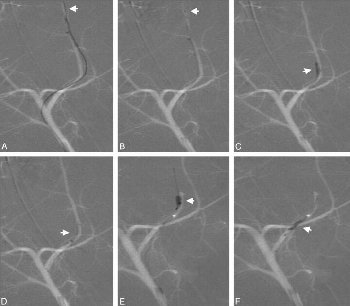 Fig 3.