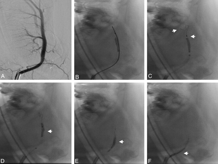 Fig 2.