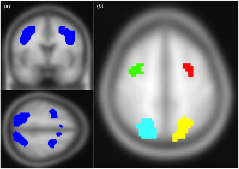 Fig 4