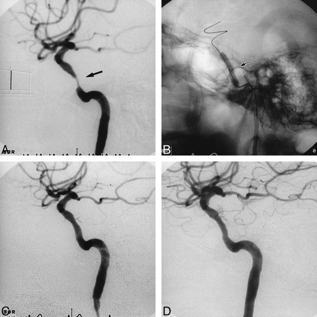 fig 3.