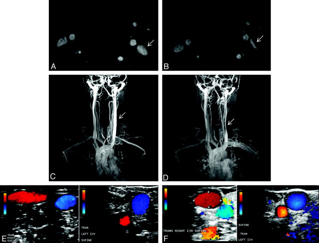 Fig 3.