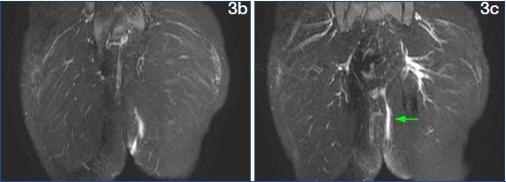 [Table/Fig-3 b & c]