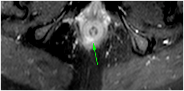 [Table/Fig-5b]