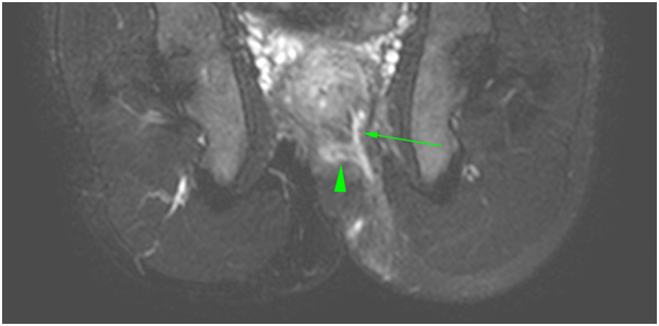 [Table/Fig-4b]