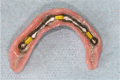 FIGURE 17