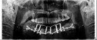 FIGURE 16