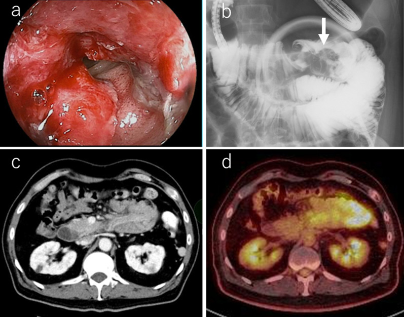 Fig. 1