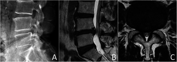 Fig. 1