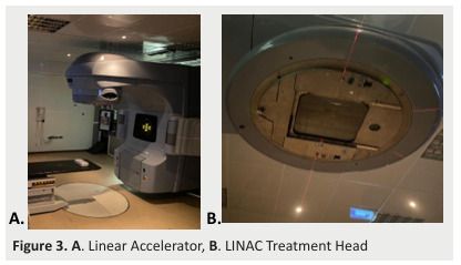 
Figure 3. A. Linear Accelerator, B. LINAC Treatment Head
