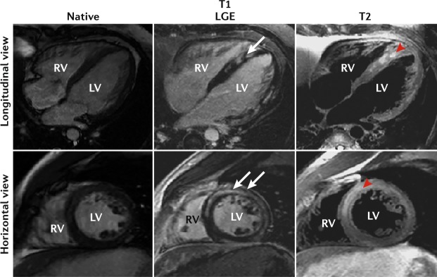 Fig. 4