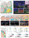 Figure 3. A, Scatter plot (top) showing a field of view of the IM region (specimen MEL1-1). The cells are colored based on recurrent cellular neighborhoods (RCN1-10) that they belong to. The yellow and blue boxes represent regions that are magnified in the bottom panel (left and right, respectively) depicted as Voronoi diagrams. B, Exemplary CyCIF images highlighting RCNs in the invasive front of specimen MEL1-1. Top, an overall view of the invasive front stained for tumor cells (S100B: blue), macrophages (CD163: cyan), T cells (CD3: red), and dendritic cells (CD11C: green). The inset squares correspond to magnified panels at the bottom. H&E staining of a serial section of the same region is represented in the top right corner. Bottom left (yellow), RCN9 enriched for dendritic cells (CD11C: green) at the tumor–stroma junction; bottom center (blue), RCN5/8 enriched with PD1+ CTLs (CD8: green; PD1: red); bottom right (red), RCN3/4 enriched with myeloid cells (CD163: magenta; CD11C: green). Scale bar, 100 μm; the dashed gray line represents the tumor–stroma boundary. C, Voronoi diagrams of a representative field of views compiled from regions of N, P, and MIS. Each cell is colored based on the recurrent cellular neighborhood (RCN1–10) to which it belongs (as in A). Examples of corresponding CyCIF images from one patient in each case are provided at the bottom row. A magnified view is available in Supplementary Fig. S3A. D, Bar plot depicting the proportional distribution of RCNs (RCN1–10) among the disease progression stages (N, P, MIS, IM, and EM). E, Box plots of the distribution of the shortest distance between cells in RCN 2–7 and RCN10 grouped based on progression stages. T test (*, P < 0.05) depicts significant changes in mean distances between the compared stages. The comparison made is described on the upper right corner of each plot (e.g., N vs. P). F, Shift plot shows the distance between melanocytes and CTLs, PDL1+ myeloid cells, and Tregs in normal (top) and precursor (bottom) regions. Significance is calculated for each percentile (10, 20, 30, 40, 50, 60, 70, 80, and 90) using the robust Harrell–Davis quantile estimator. Red indicates a significant difference (P < 0.05) and gray represents nonsignificance for each percentile.