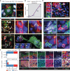 Figure 4. A, Field of MIS from a whole-slide CyCIF image of MEL1-1. A PDL1+ melanocyte (SOX10: white, PDL1: green) and CTLs (CD8: red) are being highlighted with an orange box (left). Right, the polarization of PD1 (red) and PDL1 (green) to the point of contact between the interacting cells. Scale bar, 5 or 10 μm. B, Line plot showing the percentage of ROIs that displayed significant (P < 0.05) co-occurrence based on proximity analysis performed between PDL1+ CD11C+ CD163− dendritic cells and PD1+ CTLs. C, Field of IM from a whole-slide CyCIF image of MEL1-1 stained for tumor (SOX10: red), macrophages (CD163: green), and CTLs (CD8: white), with three fields of macrophage–CTL contacts (yellow boxes). Maximum-intensity projections imaged at high-resolution in fields 1 and 2 are stained for DNA (blue), PDL1 (red), and PD1 (green) with cells labeled as myeloid cells (M) and engaged T cells (T); field 3 shows tumor cells (SOX10: red), CTLs (CD8: white) and a macrophage (CD163; green). Inset white boxes in the bottom right show concentration of PD1 (red) and PDL1 (red) to the point of contact and the long connection between a macrophage (CD163: white), and a CTL is shown in a 3D reconstruction of the field 3. Scale bar, 25 μm, 10 μm, or 4 μm. D, Left shows the same CyCIF field of view as in C, stained for DNA (blue), TIM3 (red), and CD8 (green). The white inset box illustrates the staining of one CD163+ CD11C+ TIM3+ myeloid cell next to a CTL (right). Scale bar, 25 μm. E, Maximum-intensity projection from the bTIL region (top left) stained for DNA (blue), macrophages (CD163: green), and T cells (CD3D: white). The white inset is magnified and stained for T-cell polarity (CD4: green, CD8: red), PD1–PDL1 axis (PD1: green, PDL1: red), and exhaustion markers (TIM3: red, LAG3: green). A Treg in this field is indicated with a label Tr. Scale bars, 20 and 10 μm. F, PDL1 positivity in SOX10+ tumor cells (top) and CD11C+ myeloid cells (bottom). The proportions of PDL1+ tumor cells to all tumor cells (0%–5%, 5%–20%, and >20%) and PDL1+ myeloid cells to all myeloid cells (<1%, 1%–25%, and >25%) are presented in both primary melanoma cohorts (cohort 1: MEL1–13 and cohort 2: 25 primary melanomas). G, Fields of a primary melanoma and a melanoma metastasis from CyCIF images stained for DNA (blue), SOX10 (green), PDL1 (red), and CD11c (white). Top, an example of PDL1+ SOX10+ tumor cells at the deepest invasive region. PDL1+ metastasis is shown in the bottom panel. The tumor–stroma interface is indicated with a white dashed line. Scale bars, 100 and 10 μm.