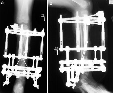 Fig. 14