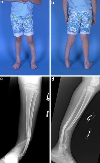 Fig. 18