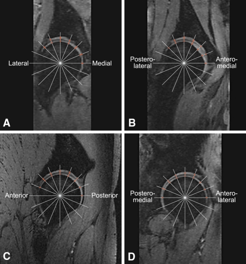 Fig. 1A–B