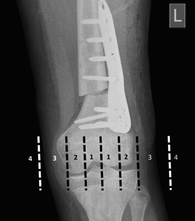 Fig. 1