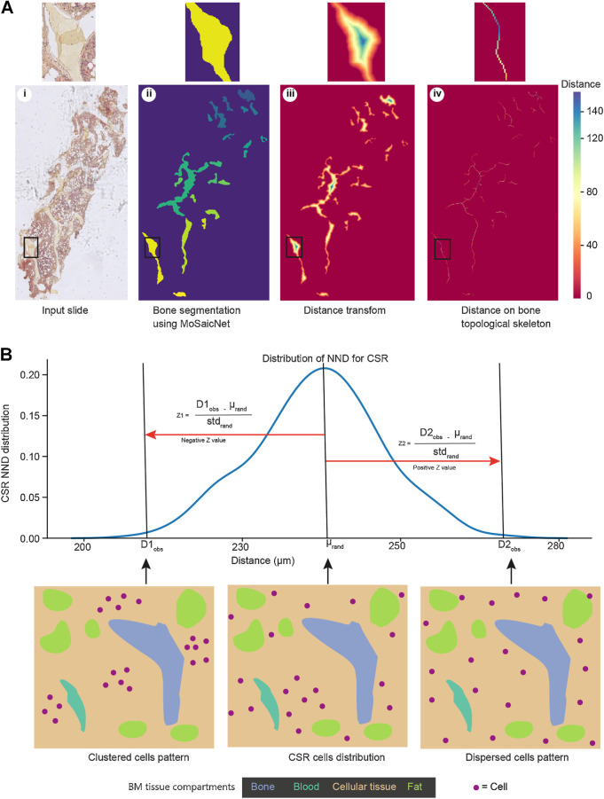 Figure 2. Computational methods for bone thickness analysis and cell infiltration patterns: A, Image analysis to estimate bone thickness (Supplementary Materials and Methods). Using the same BM sample image as Fig. 1A, the bone segmentation (ii) is an output of MoSaicNet (Supplementary Materials and Methods), and each bone is displayed in a different color. The color bar shows the pixel intensity of the image in iii and iv. The pixel intensity on the skeleton indicates half of the bone thickness (Supplementary Materials and Methods). B, Cell infiltration pattern analysis using NND and the null hypothesis of CSR (Supplementary Materials and Methods). Z < −1.96, Z > 1.96, and −1.96 ≤ Z ≤ 1.96 indicate a clustered, dispersed, and random distribution of observed cells, respectively. std, standard deviation; μ, mean NND of CSR.