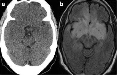 Fig. 11