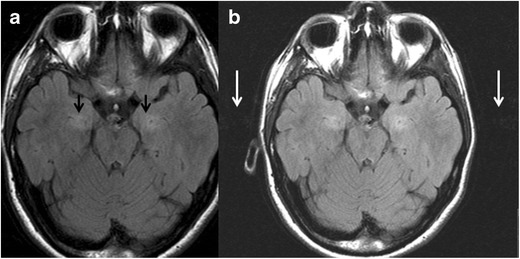 Fig. 17