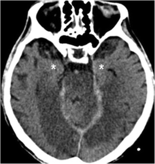 Fig. 13