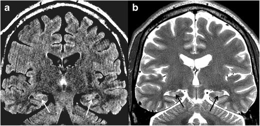 Fig. 10