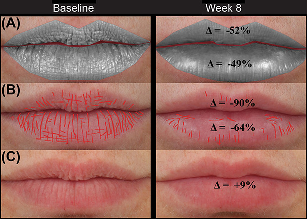 Figure 2: