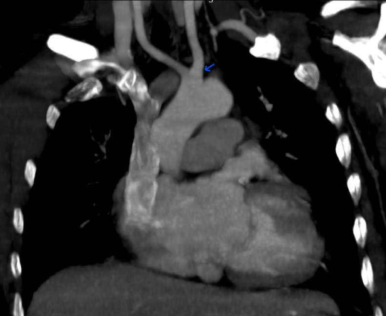 Fig 5