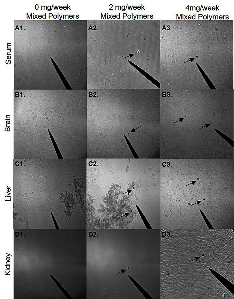 Figure 2 is a stained tissue displays three rows, namely, 0 milligram per week mixed polymers, 2 milligrams per week polymers, 4 milligrams per week mixed polymers, and four columns, namely, serum, brain, liver, and kidney. The arrows depict the microspheres.