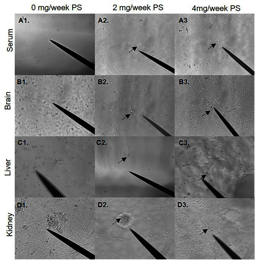 Figure 1 is a stained tissue displays three rows, namely, 0 milligram per week polystyrene, 2 milligrams per week polystyrene, 4 milligrams per week polystyrene, and four columns, namely, serum, brain, liver, and kidney. The arrows depict the polystyrene microspheres.