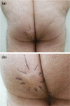 Fig. 1