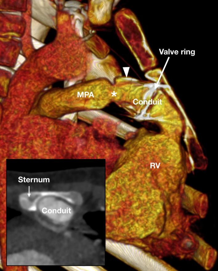 Figure 18. 