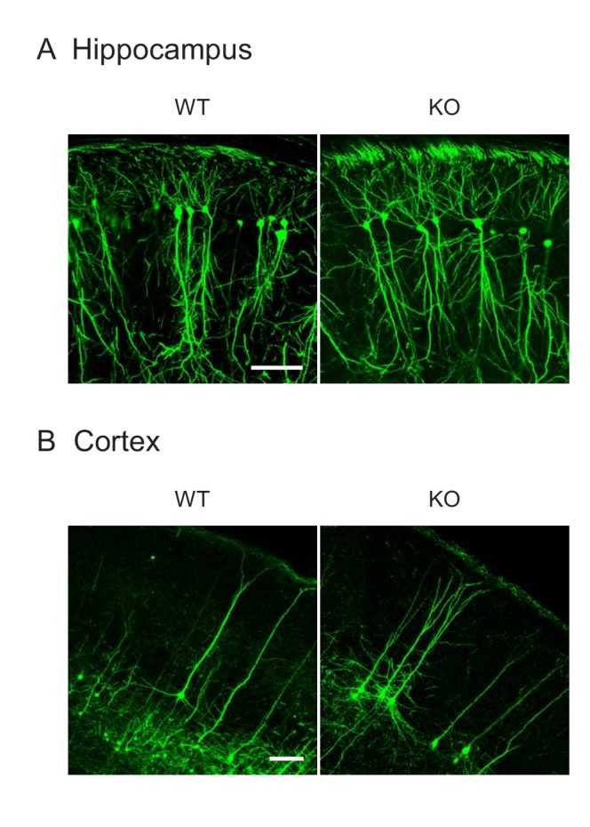 Figure 4—figure supplement 2.