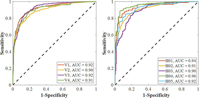 Performance of CV19-Net. (a) Receiver operating characteristic curve of the total test data set (left) with 5869 chest radiographs and the probability score distribution (right). (b) Pooled performance of the three chest radiologists compared with CV19-Net for the 500 test cases. (c) Receiver operating characteristic curves of CV19-Net for different vendors (V1–V4) and hospitals (H01–H05) in the test data set. AUC = area under the receiver operating characteristic curve, COVID-19 = coronavirus disease 2019.