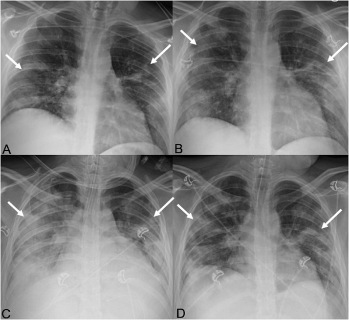 FIG 2