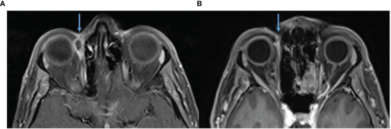 Figure 4