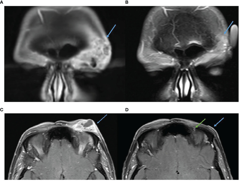 Figure 6